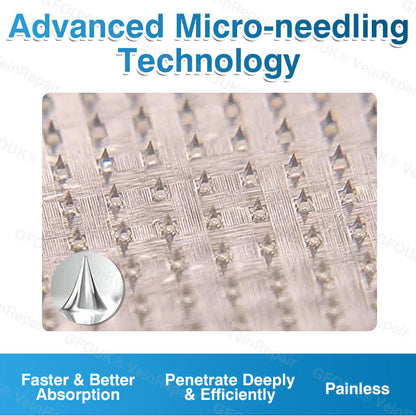 es🏆✅️🏃NREOEO® Parche de microagujas para reparación de venas⚡Alivio instantáneo, resultados a largo plazo