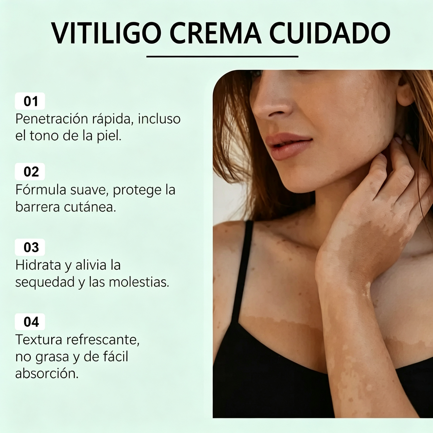 Crema de cuidado para piel con manchas blancas