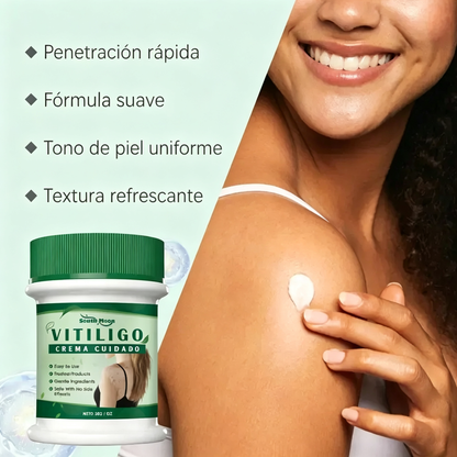 Crema de cuidado para piel con manchas blancas