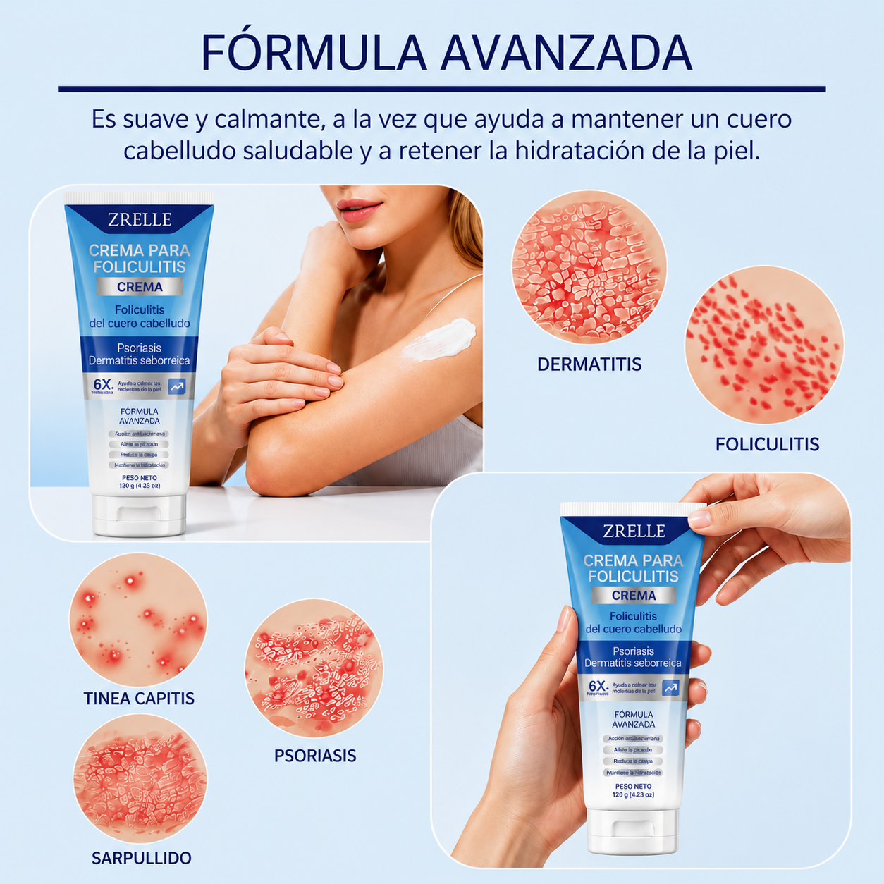 Crema para la foliculitis | Calma y ayuda a eliminar los granitos del cuero cabelludo, la cara, el cuerpo y los glúteos | Para vellos encarnados, irritación por afeitado y acné