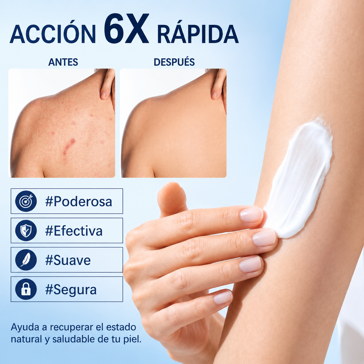 Crema para la foliculitis | Calma y ayuda a eliminar los granitos del cuero cabelludo, la cara, el cuerpo y los glúteos | Para vellos encarnados, irritación por afeitado y acné