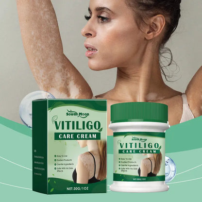Crema de cuidado para piel con manchas blancas